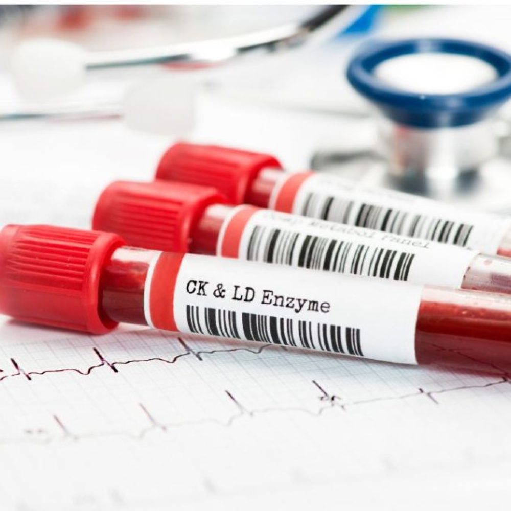 Comprehensive blood testing (UK only)