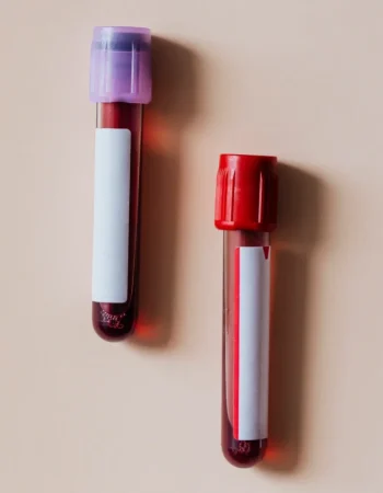 After your professional at-home blood test, your sample is securely sent to our accredited laboratory for analysis.